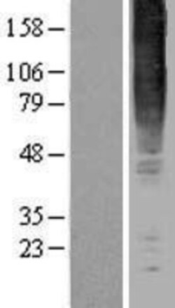 Novus Biologicals&trade;&nbsp;GPR83 Overexpression Lysate