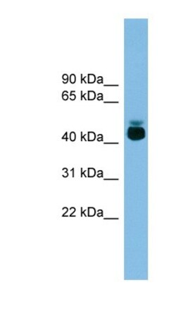 GPR87 Antibody, Novus Biologicals 100&mu;L; Unlabeled:Antibodies, Polyclonal