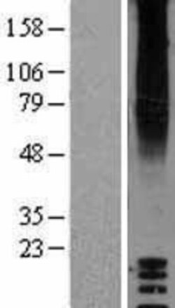 Novus Biologicals&trade;&nbsp;GPR87 Overexpression Lysate