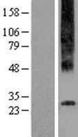 Novus Biologicals™ GPR97 Overexpression Lysate