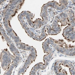 G protein alpha Inhibitor 2 Antibody, Novus Biologicals:Antibodies:Primary