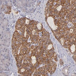 G Protein alpha z Antibody, Novus Biologicals 0.1mL; Unlabeled:Antibodies,