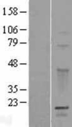Novus Biologicals&trade;&nbsp;GPSM3 Overexpression Lysate