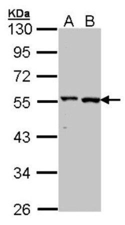 GPT Antibody, Novus Biologicals 0.1mL; Unlabeled:Antibodies, Polyclonal