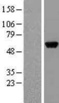 Novus Biologicals&trade;&nbsp;GPT Overexpression Lysate