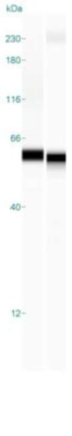 GPT2 Antibody, Novus Biologicals 25ul | Buy Online | Novus Biologicals | Fisher Scientific