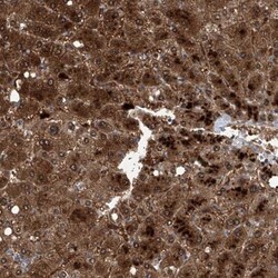 GPT Antibody, Novus Biologicals 0.1mL; Unlabeled:Antibodies, Polyclonal