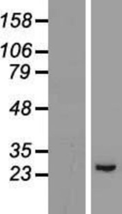 Novus Biologicals&trade;&nbsp;GPX8 Overexpression Lysate