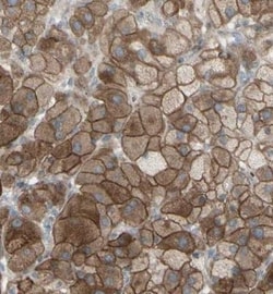 GRAMD1B Antibody, Novus Biologicals 0.1mL; Unlabeled:Anticuerpos