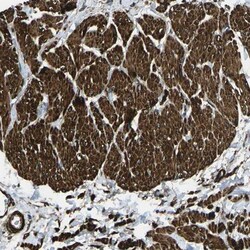 GRAMD1C Antibody, Novus Biologicals:Antibodies:Primary Antibodies