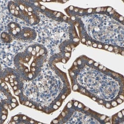 GRAMD3 Antibody, Novus Biologicals 0.1mL; Unlabeled:Antibodies, Polyclonal