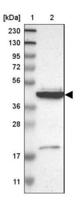 GRAMD3 Antibody, Novus Biologicals 0.1mL; Unlabeled:Antibodies, Polyclonal