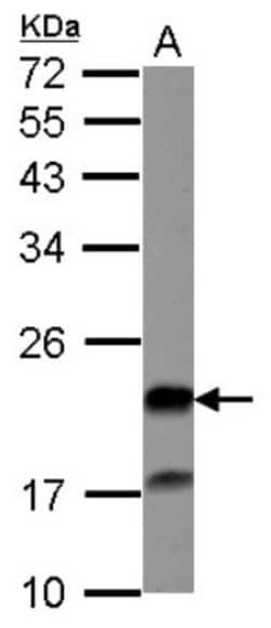 Grancalcin Antibody, Novus Biologicals 0.1mL; Unlabeled:Antibodies, Polyclonal