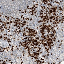 Grancalcin Antibody, Novus Biologicals 0.1mL; Unlabeled:Antibodies, Polyclonal