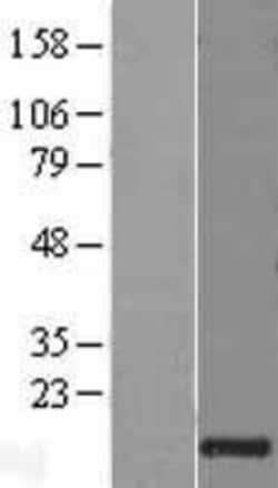 Novus Biologicals&trade;&nbsp;Granulysin Overexpression Lysate