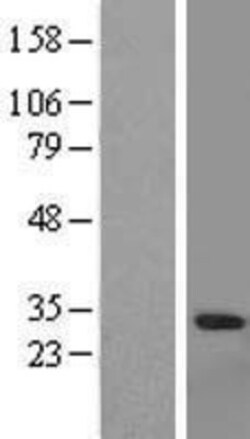 Novus Biologicals&trade;&nbsp;Granzyme A Overexpression Lysate