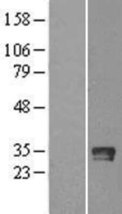 Novus Biologicals&trade;&nbsp;Granzyme B Overexpression Lysate