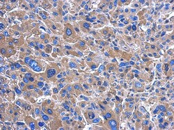 GRAP Antibody, Novus Biologicals 0.1mL; Unlabeled:Antibodies, Polyclonal