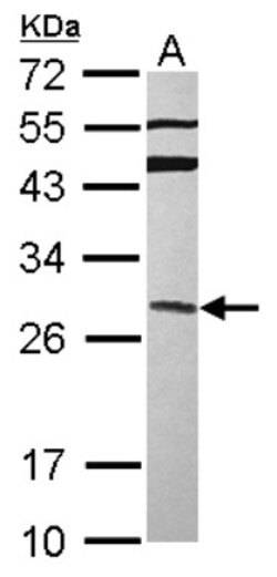 GRAP Antibody, Novus Biologicals 0.1mL; Unlabeled:Antibodies, Polyclonal