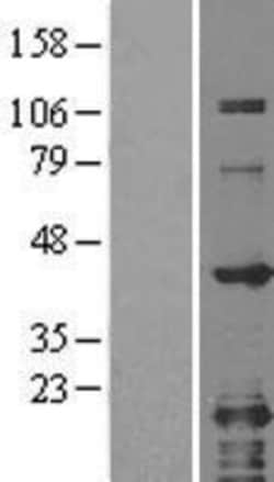 Novus Biologicals&trade;&nbsp;GRAP2 Overexpression Lysate