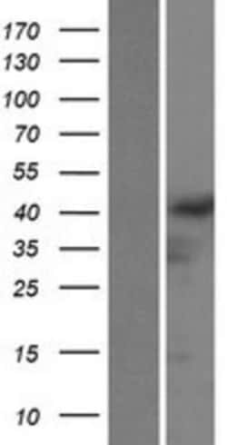 Novus Biologicals&trade;&nbsp;GRASP Overexpression Lysate