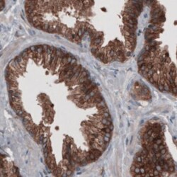GRASP55 Antibody (CL2522), Novus Biologicals:Antibodies:Primary Antibodies