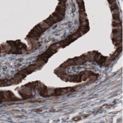 GRASP55 Antibody (CL2522), Novus Biologicals:Antibodies:Primary Antibodies
