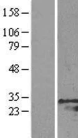 Novus Biologicals&trade;&nbsp;GRB2 Overexpression Lysate