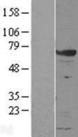 Novus Biologicals&trade;&nbsp;GRB7 Overexpression Lysate