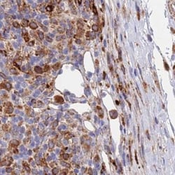 GREB1L Antibody, Novus Biologicals:Antibodies:Primary Antibodies