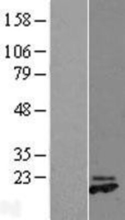 Novus Biologicals&trade;&nbsp;PRDC/GREM2 Overexpression Lysate
