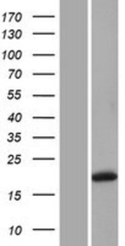 Novus Biologicals&trade;&nbsp;Gremlin 1 Overexpression Lysate