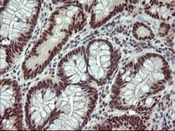 GRF2 Antibody (OTI2F5), Novus Biologicals 0.1mL; Unlabeled:Antibodies,