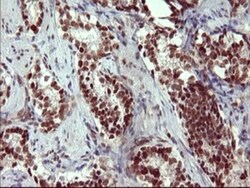 GRF2 Antibody (OTI2F5), Novus Biologicals 0.1mL; Unlabeled:Antibodies,