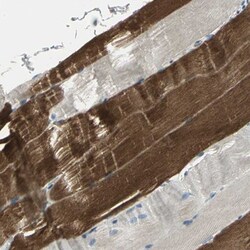 GRF2 Antibody, Novus Biologicals:Antibodies:Primary Antibodies