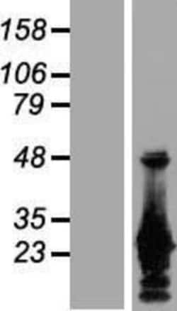 Novus Biologicals&trade;&nbsp;GRG (Groucho homolog) Overexpression Lysate