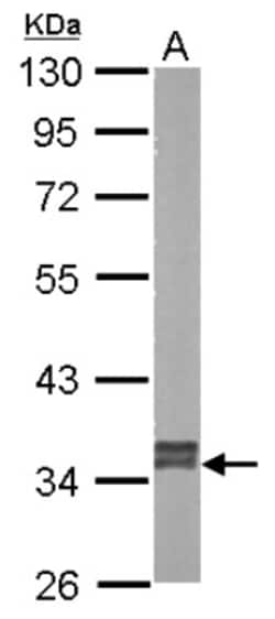 GRHPR Antibody, Novus Biologicals 0.1mg; Unlabeled:Antibodies, Polyclonal