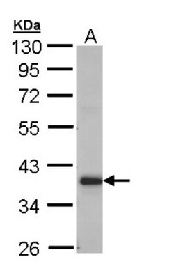 GRHPR Antibody, Novus Biologicals 0.1mg; Unlabeled:Antibodies, Polyclonal