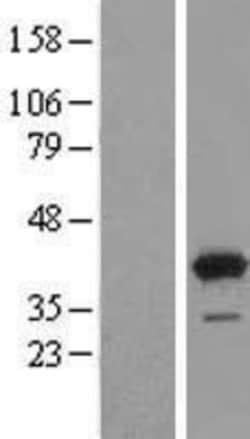 Novus Biologicals™ GRHPR Overexpression Lysate