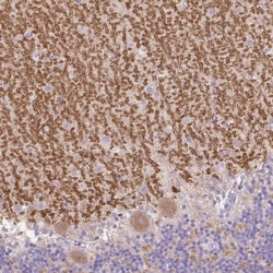 GRID2 Antibody, Novus Biologicals 25 &mu;L | Buy Online | Novus Biologicals | Fisher Scientific