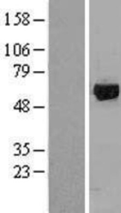 Novus Biologicals&trade;&nbsp;GRK1 Overexpression Lysate