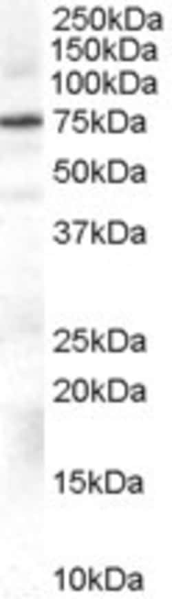 GRK2 Antibody, Novus Biologicals 0.1mg; Unlabeled:Antibodies, Polyclonal