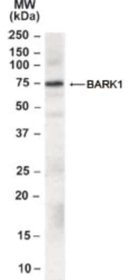 GRK2 Antibody, Novus Biologicals 0.1mg; Unlabeled:Antibodies, Polyclonal