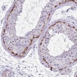 GRK4 Antibody, Novus Biologicals 0.1mL; Unlabeled:Antibodies, Polyclonal