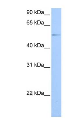 GRK4 Antibody, Novus Biologicals:Antibodies:Primary Antibodies