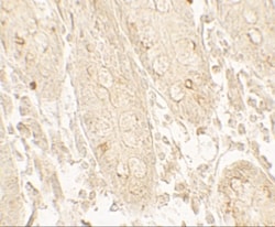 GRK6 Antibody - BSA Free, Novus Biologicals 0.1mg; Unlabeled:Antibodies,