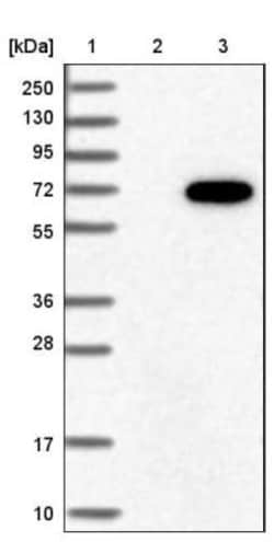 GRK6 Antibody, Novus Biologicals:Antibodies:Primary Antibodies