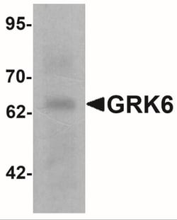 GRK6 Antibody - BSA Free, Novus Biologicals 0.1mg; Unlabeled:Antibodies,