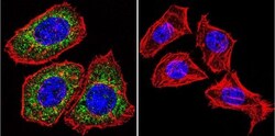 GR/NR3C1 Antibody (BuGR2) - BSA Free, Novus Biologicals 0.1mg; Unlabeled:Antibodies,