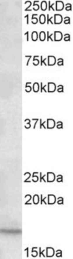GRO2 Antibody, Novus Biologicals 0.1mg; Unlabeled:Antibodies, Polyclonal